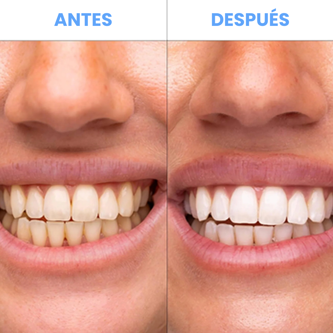 Nuvora™ Tiras Blanquedoras Dentales