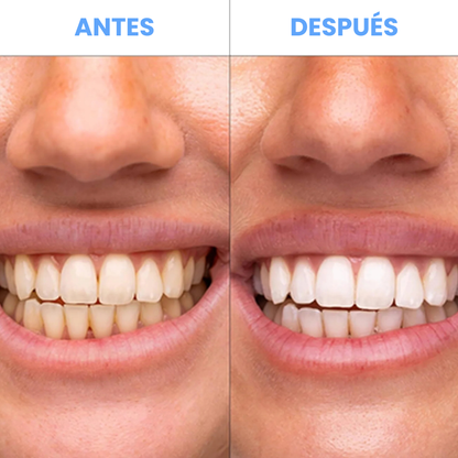 Nuvora™ Tiras Blanquedoras Dentales