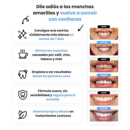 Nuvora™ Tiras Blanquedoras Dentales